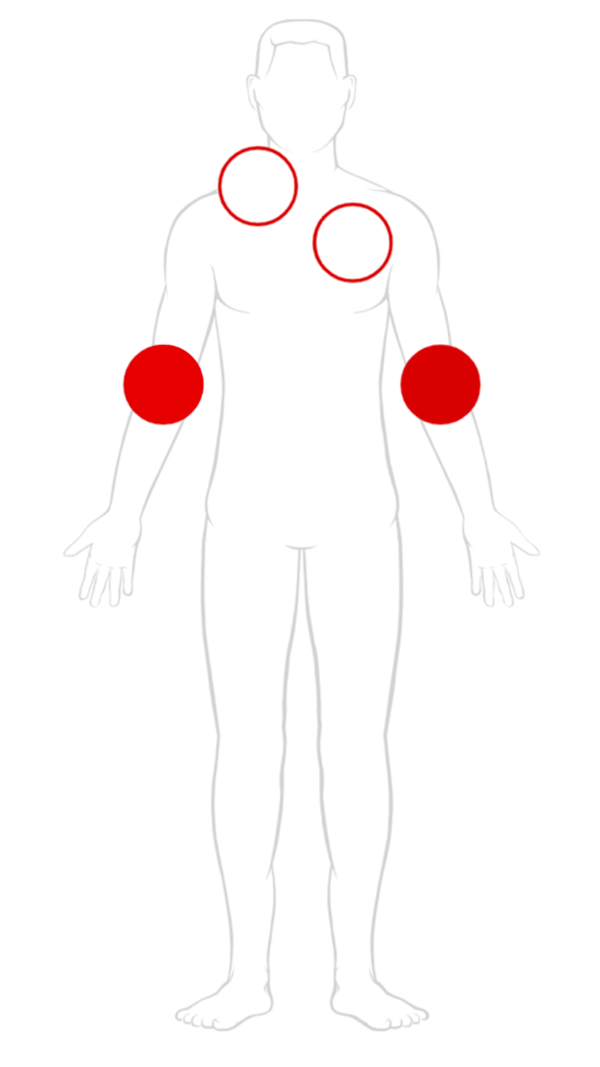 diagram of a body with both arms highlighted