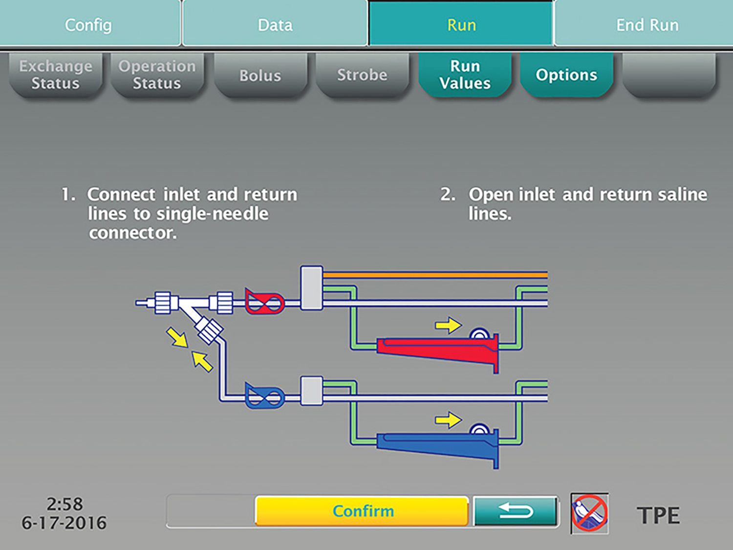  Graphical User Interface (GUI) for TPE with single needle access