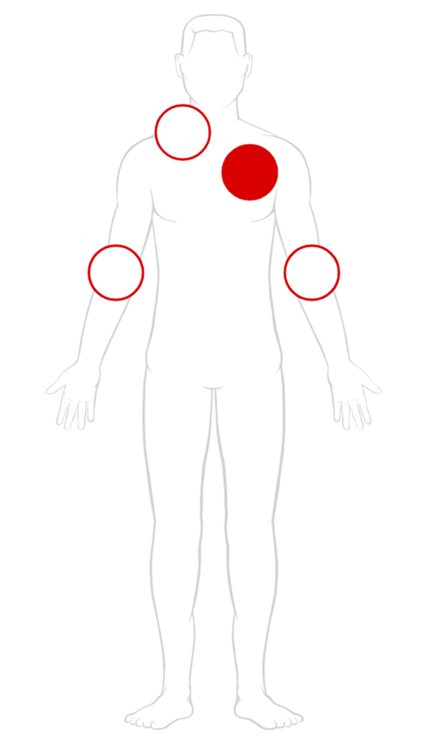 diagram of a body with the right chest highlighted