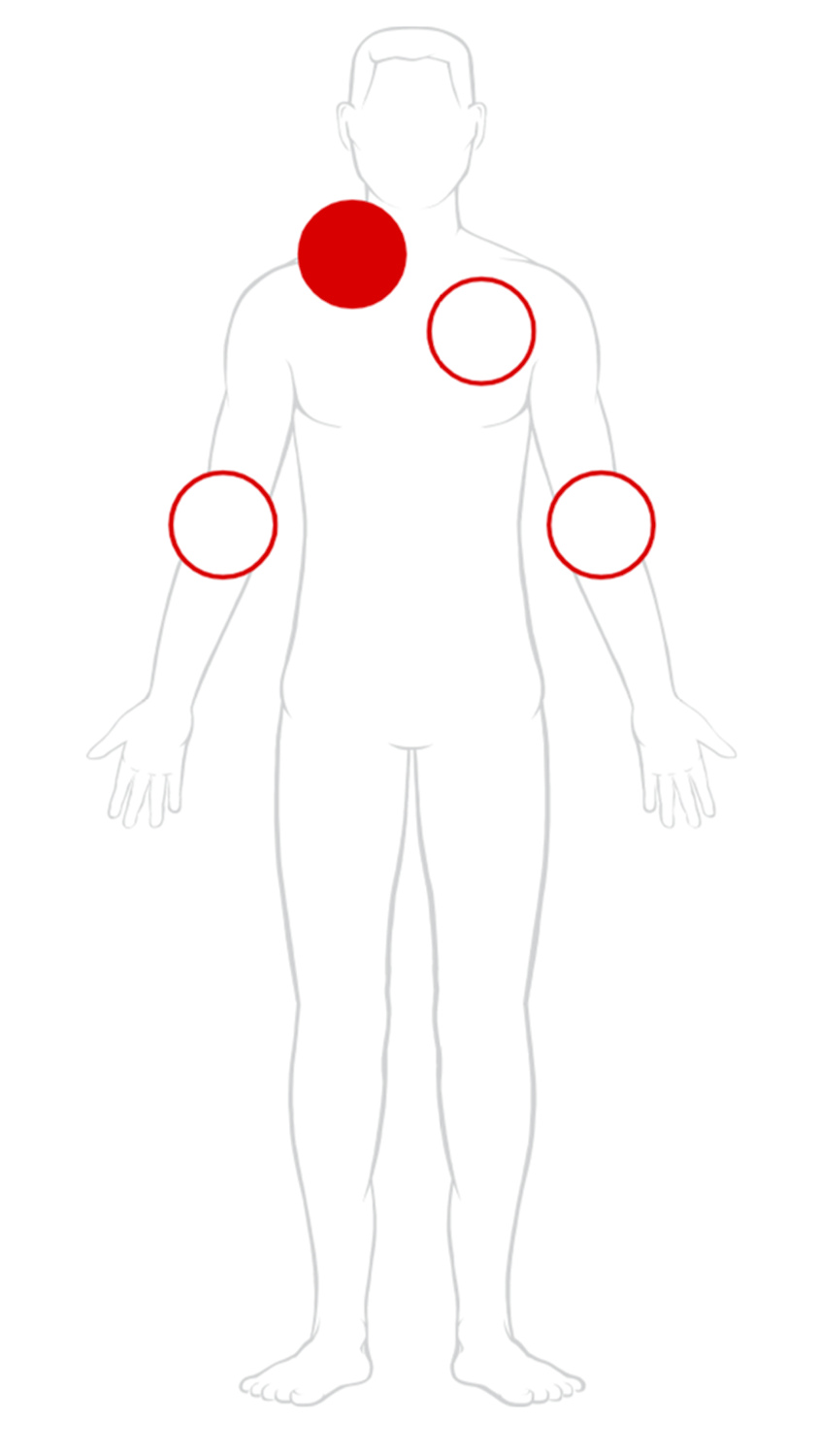 diagram of a body with the left neck highlighted