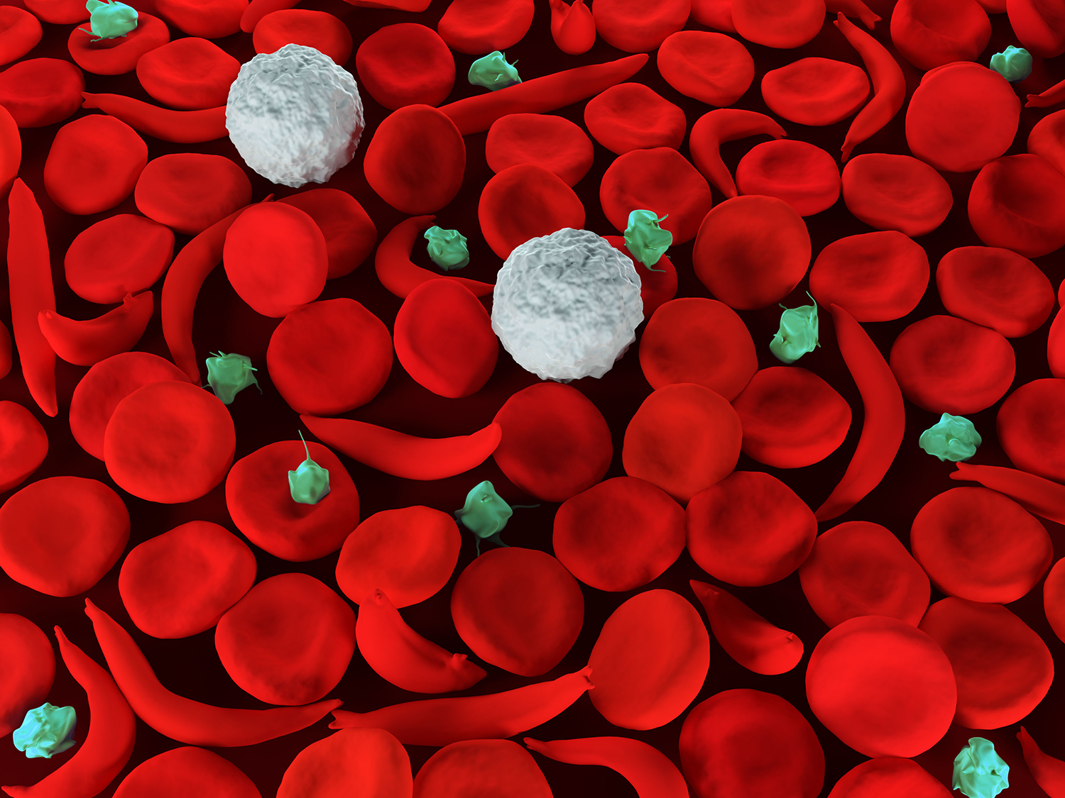 Sickled red blood cells