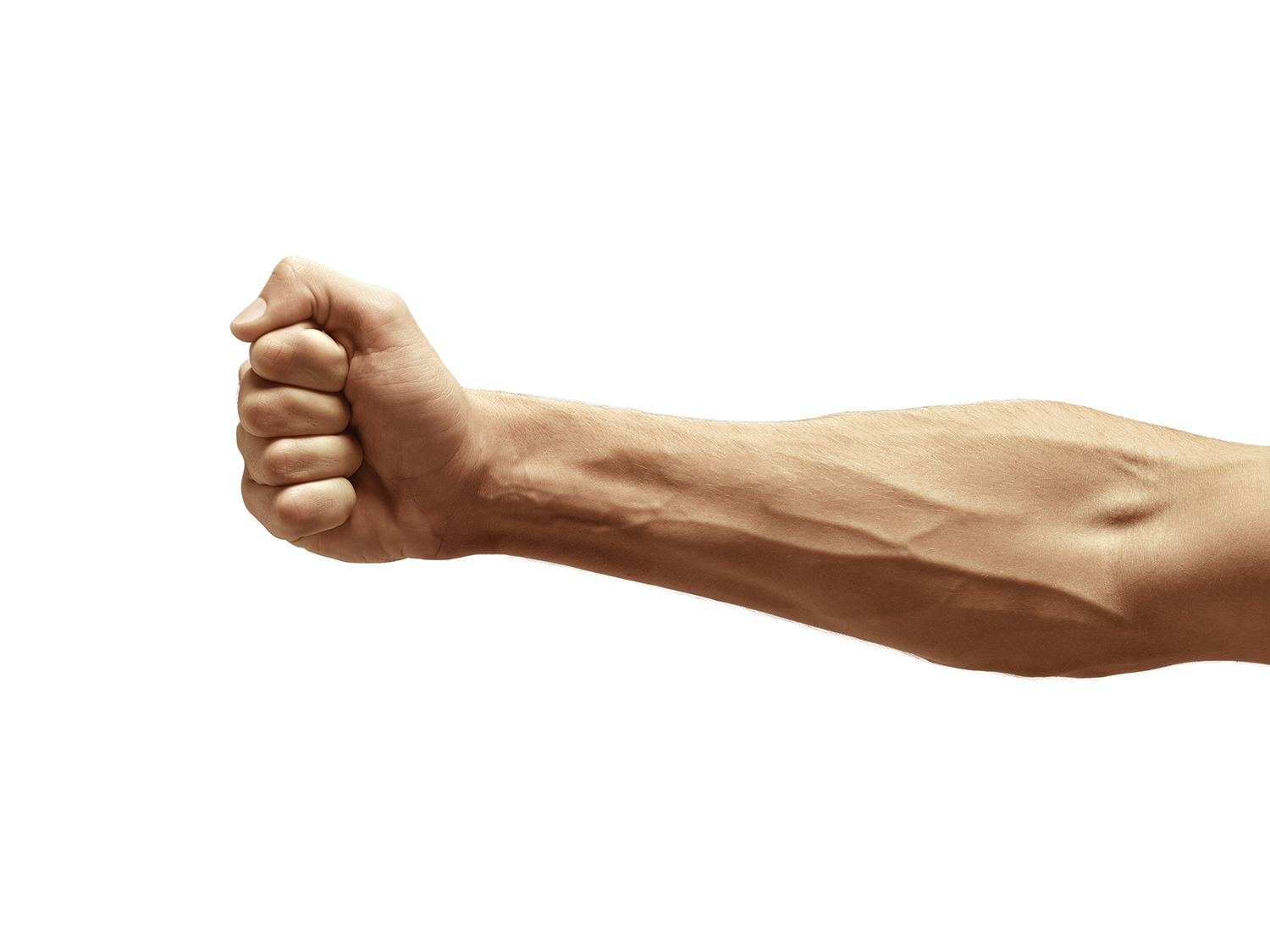 Vascular access - image of arm